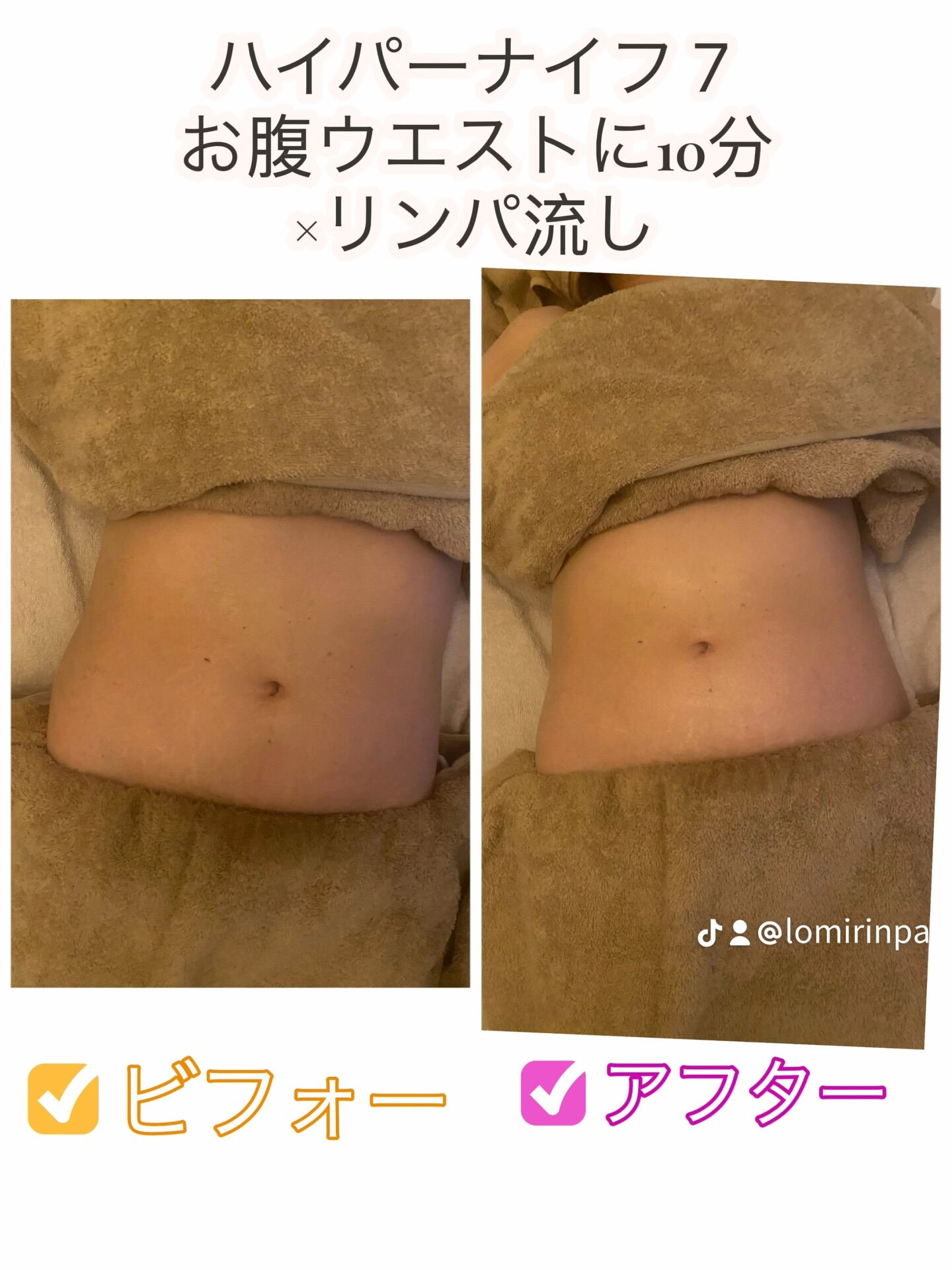 「お洋服を着ている時は痩せて見えるのに、脱ぐと意外とぽっちゃ